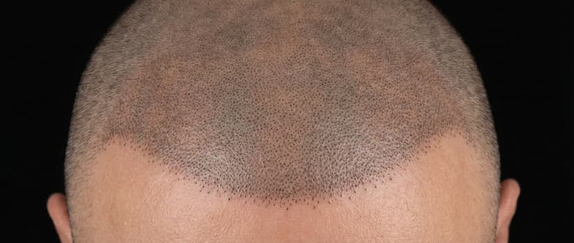 Reconstructive diagram